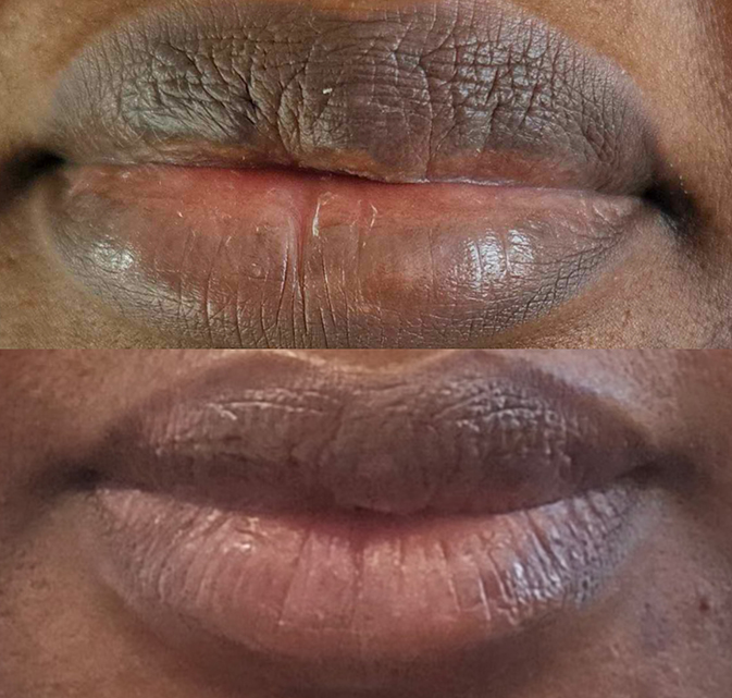Maquillage permanent Charlesbourg